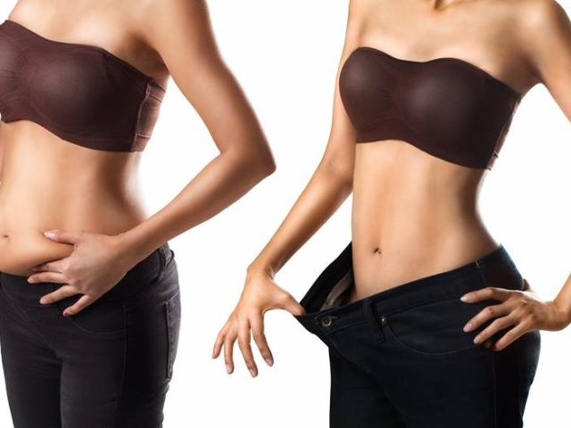 yag aldirma liposuction